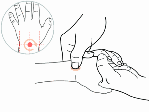 瓦特鼻炎不能艾灸2019年芳馨鼻窦炎案例①