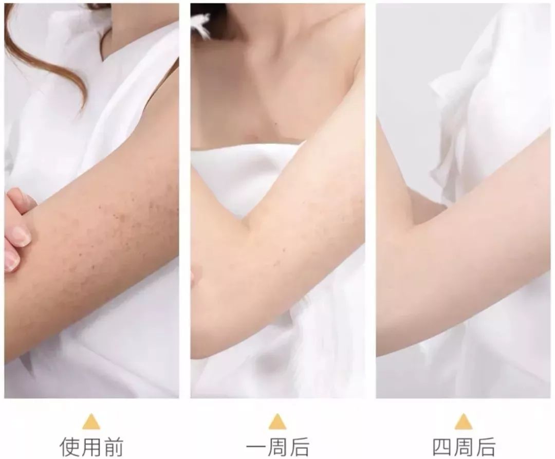 天生黑克星用它去除老废角质全身美白无死角