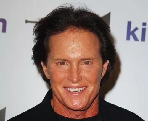 从男人变成女人,从bruce jenner到更名caitlyn jenner;▼从丈夫变成