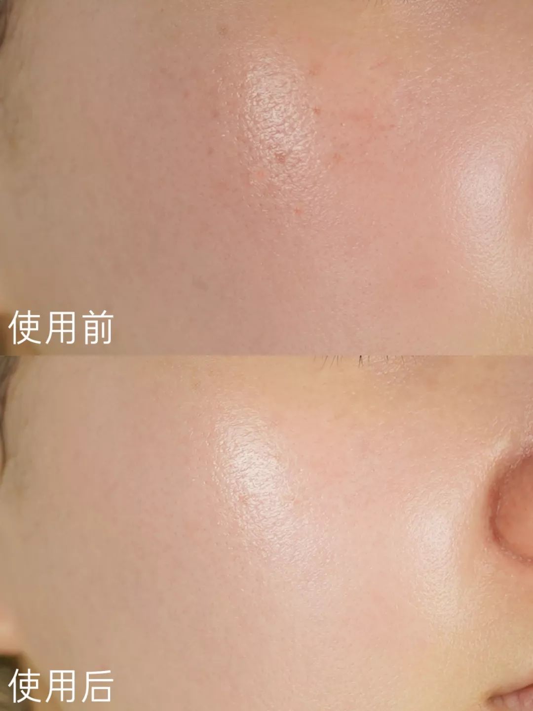 揭秘|刷酸后的自救流程,你都知道吗?_肌肤