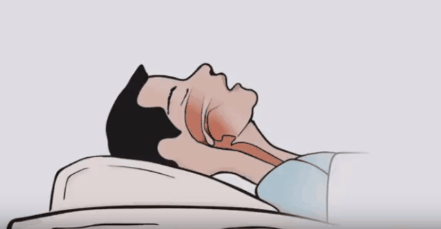 所以,打鼾的人可能会有几秒或十几秒不吱声,之后突然大喘气,像在憋气