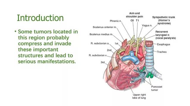 journalclub颈胸交界肿瘤的手术入路