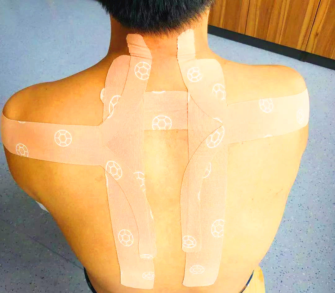 图为康复治疗师为骨性关节炎,颈椎病患者,进行个性化"设计"贴扎不过