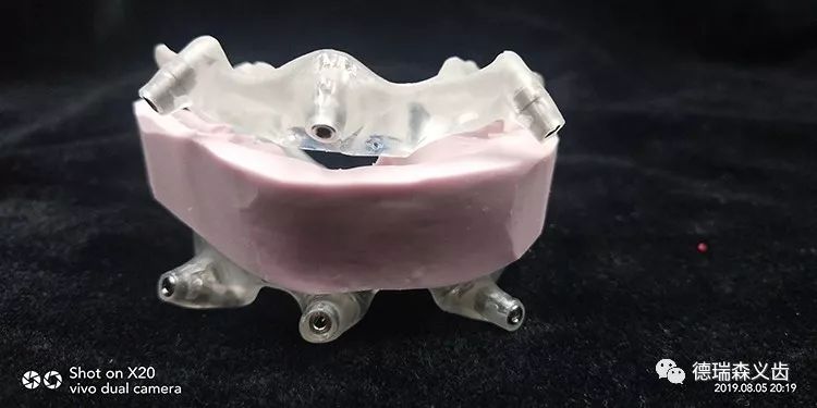 种植用手术导板