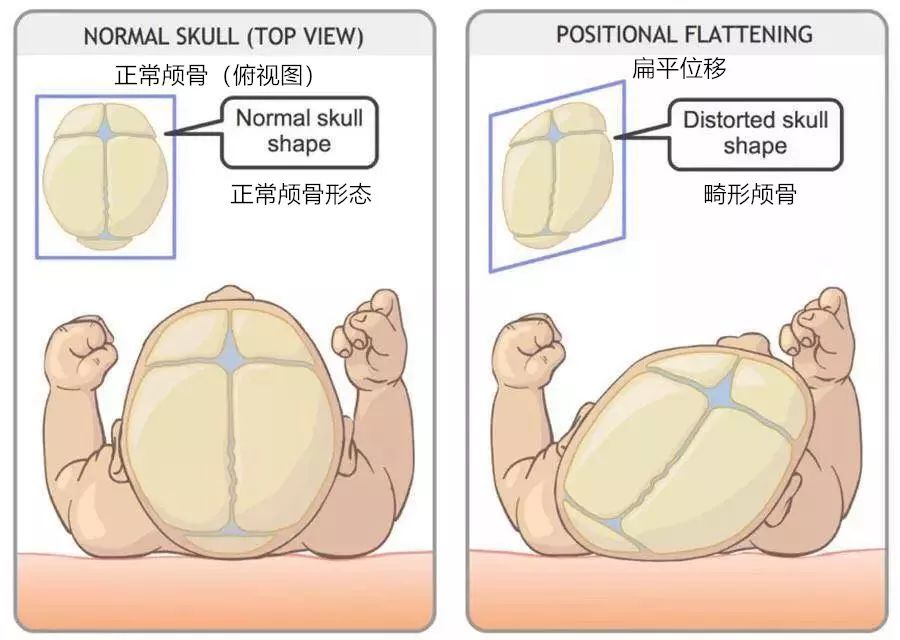婴儿正常头颅图片图片
