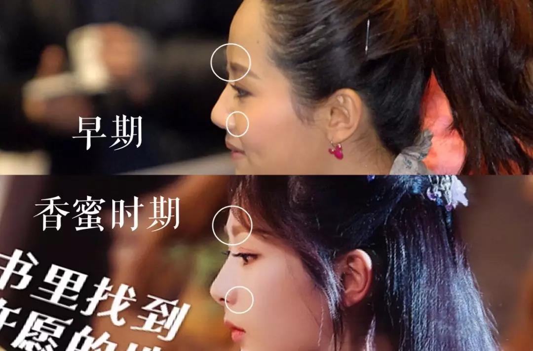 整形天花板为什么杨紫换头17年依然是路人脸