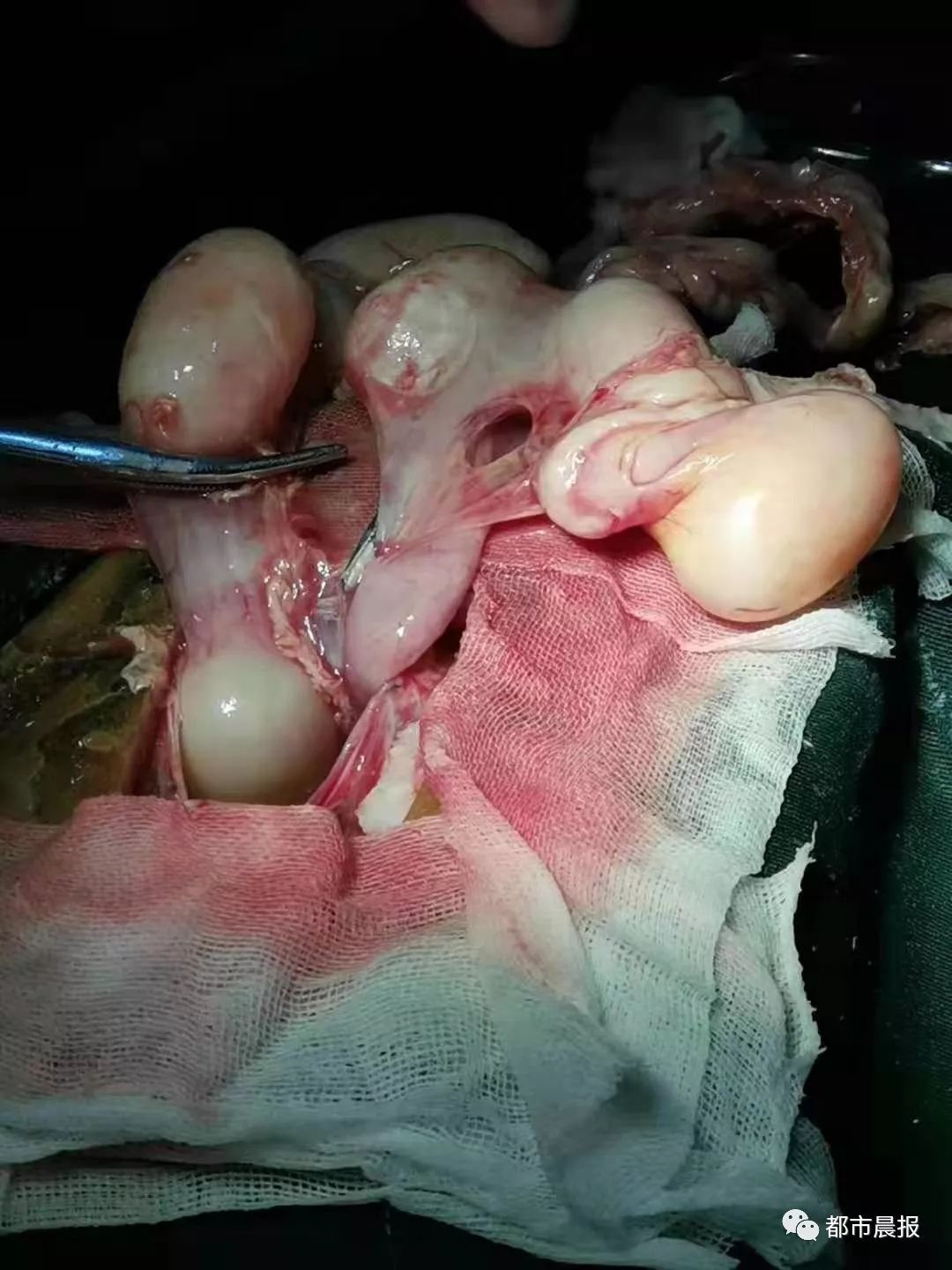 35岁高龄乌龟难产主人从山东奔赴徐州带它剖腹产最终