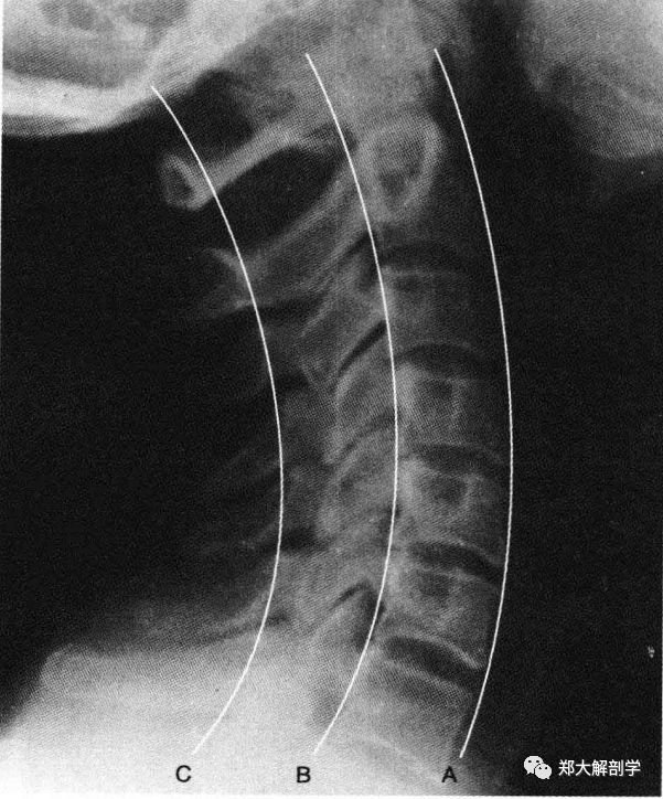 正常的颈椎x光图片图片