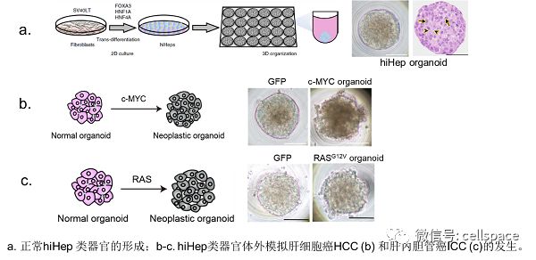 惠利健组合作利用人源肝脏类器官模拟肝癌发生_细胞