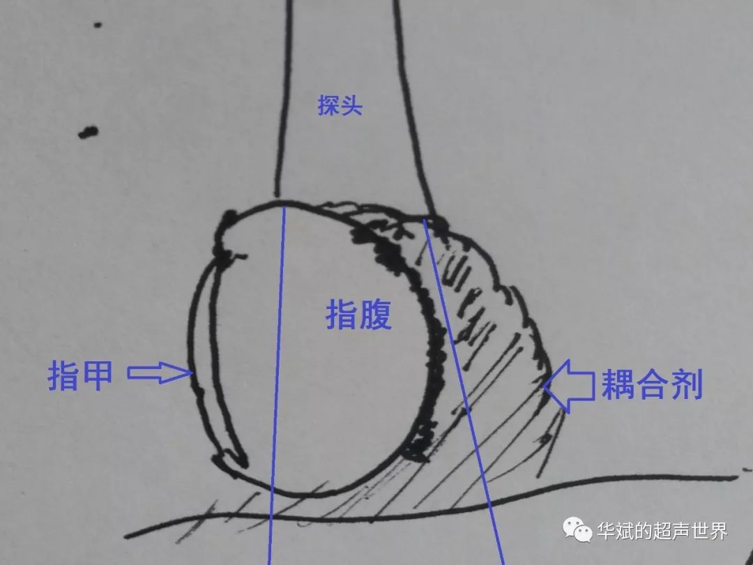 手指上需要堆积较多的耦合剂(或者利用导声垫),探头从侧面进行扫查,让