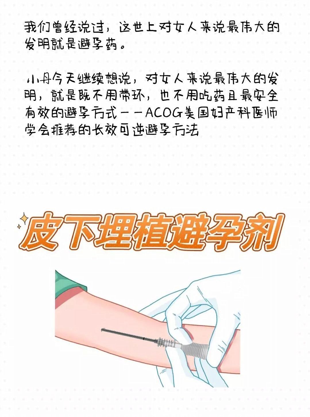 皮下埋植五大优势及注意事项