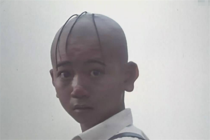 原创曾演三毛红遍全国却因秃顶不再出现如今复出如小鲜肉