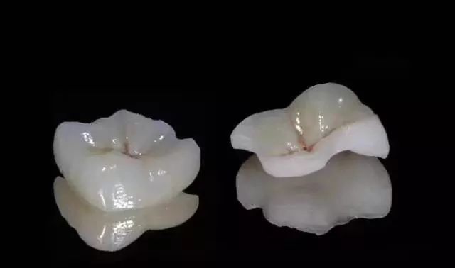 聊城市第四人民医院口腔科开展嵌体技术_张洪乐