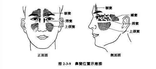 鼻窦又称鼻旁窦,副鼻窦.鼻腔周围多个含气的骨质腔.