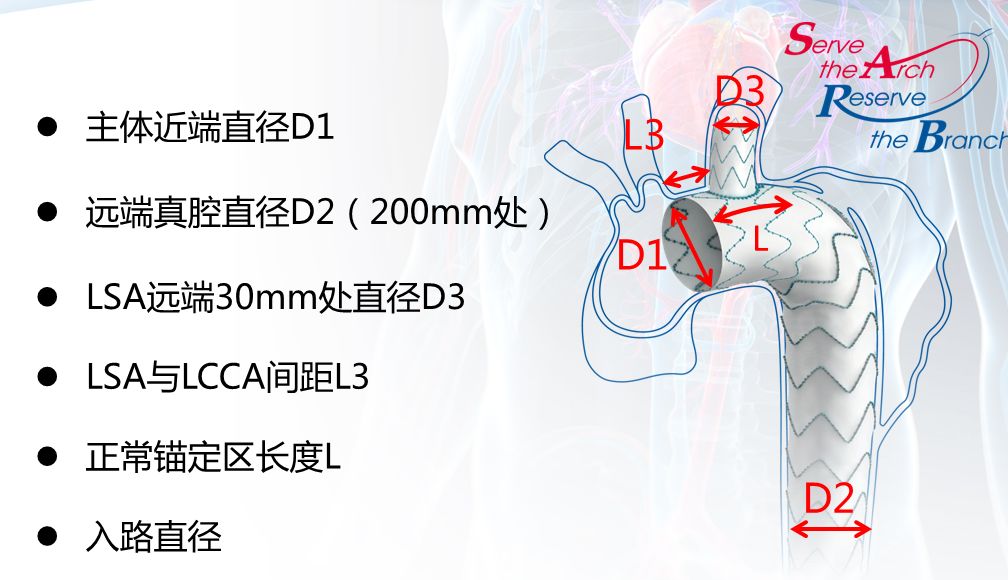 南华大学附属第一医院应用castor03分支型支架治疗逆撕性a型夹层一