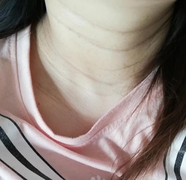 关于颈纹的日常护理,坚持下去会更紧致细腻,不去颈纹老十岁!_颈部
