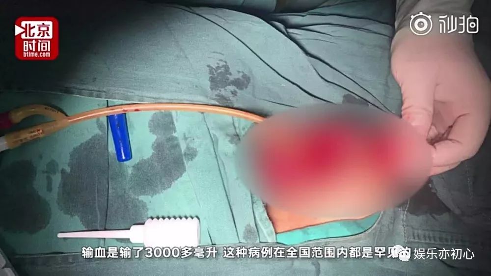 18岁男生用剪刀自宫,背后原因让人震惊: 家有男孩的家长, 这是你最不