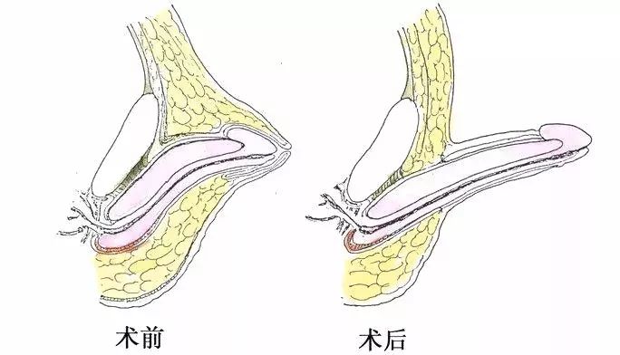 临床动态建国医院专家团队妙手施治12岁男孩丁丁重见天日