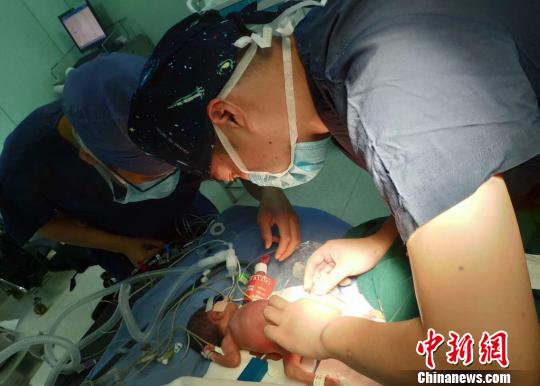 为950克袖珍宝宝动手术 浙江嘉兴医生合力书写生命奇迹