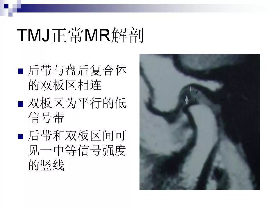 颞下颌关节的磁共振成像影像天地