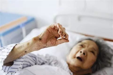 夺走老人生命的不是疾病而是卧床