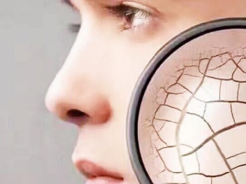 干皮护肤指南你get到了吗