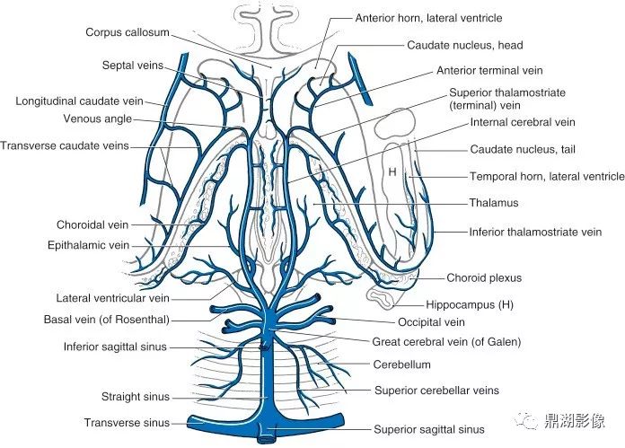 头静脉弓的解剖图片图片
