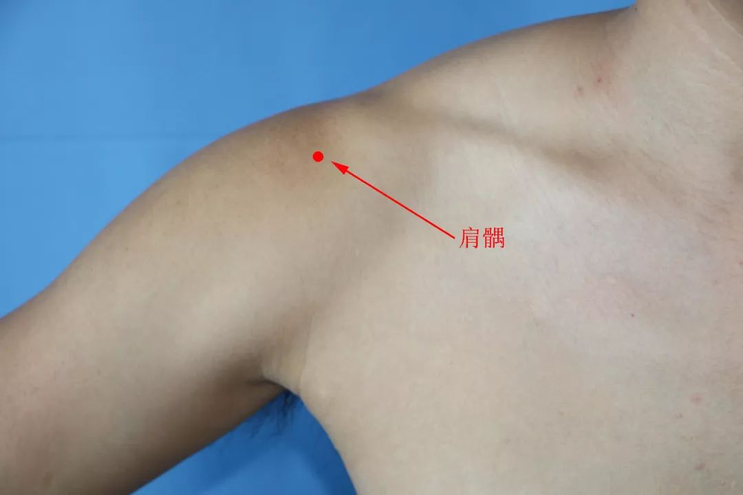肩周炎的准确位置图片图片