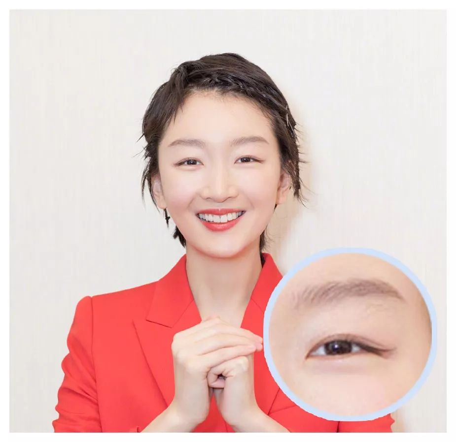 单眼皮,肿眼泡,内双也有救!