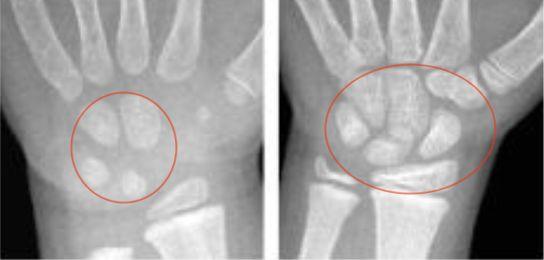 骨头里藏着的这些秘密能让你长高后悔知道晚了