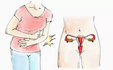 女性盆腔疼痛位置图片图片