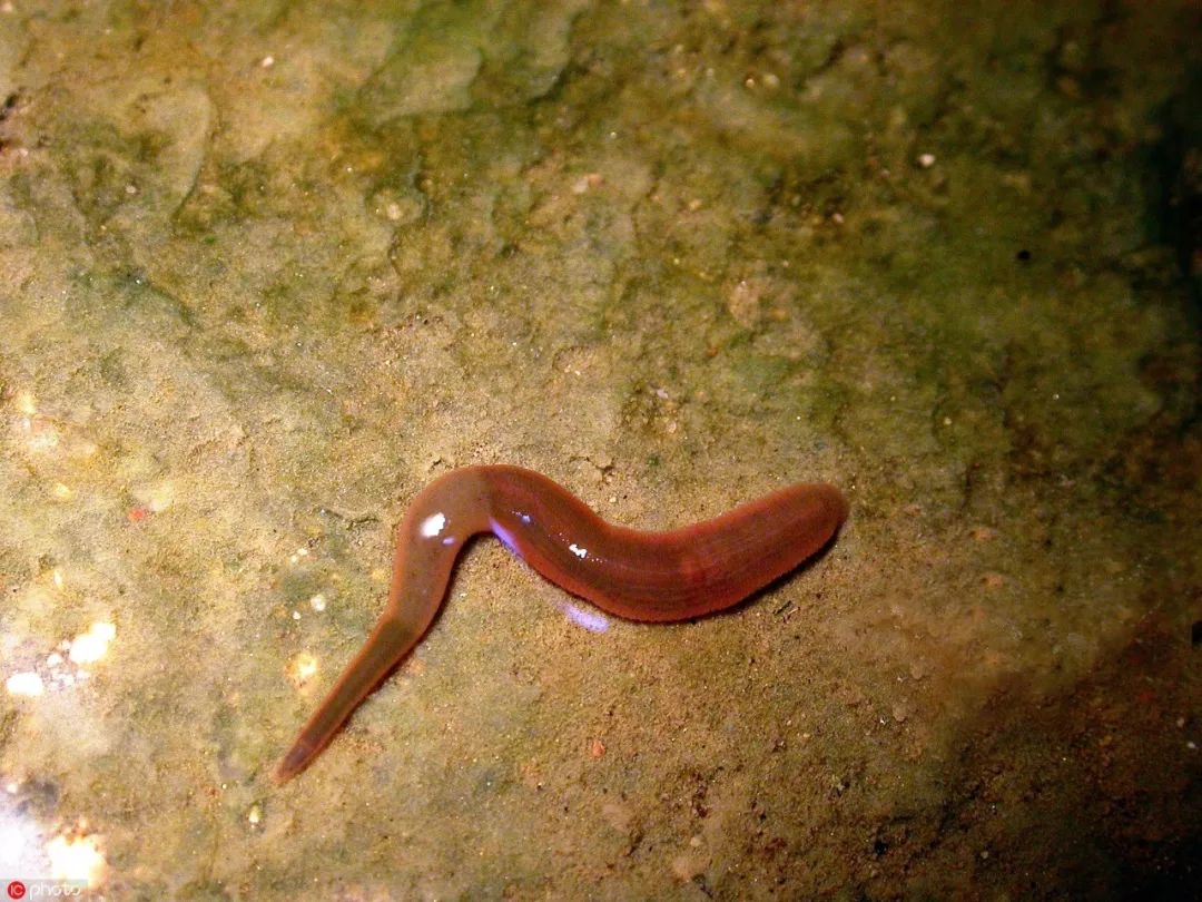 对自己下手真狠!19岁小伙为了祛痘,把10只水蛭放脸上!