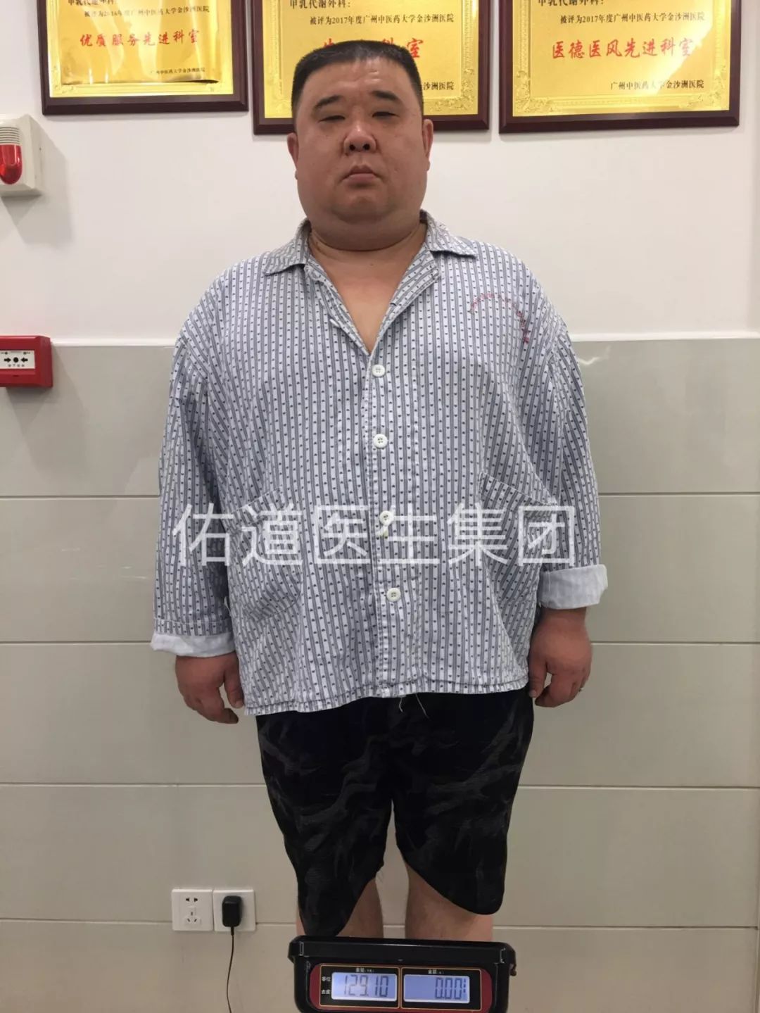 零食,夜宵,爱喝碳酸饮料,1米76的他体重一路飙升到260斤,啤酒肚越来越