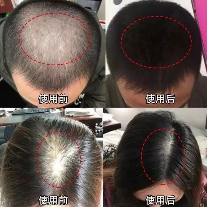 轻轻一喷头发就能增长?这款日本生发液pick了!_产品