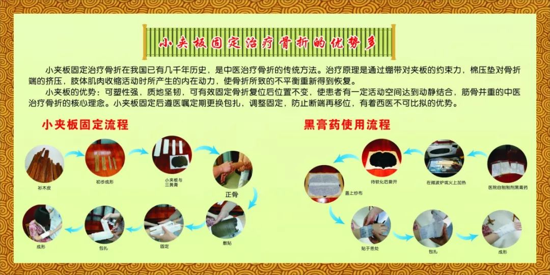 中医正骨神奇的骨伤疗法