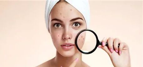 一半以上的妇科疾病都是因为卫生巾?别再那么随意了_细菌