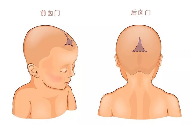 三角头畸形 冠状缝图片