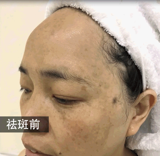 30万送儿子留学,回来嫌我"祛斑"太花钱!女人要不要省一辈子?