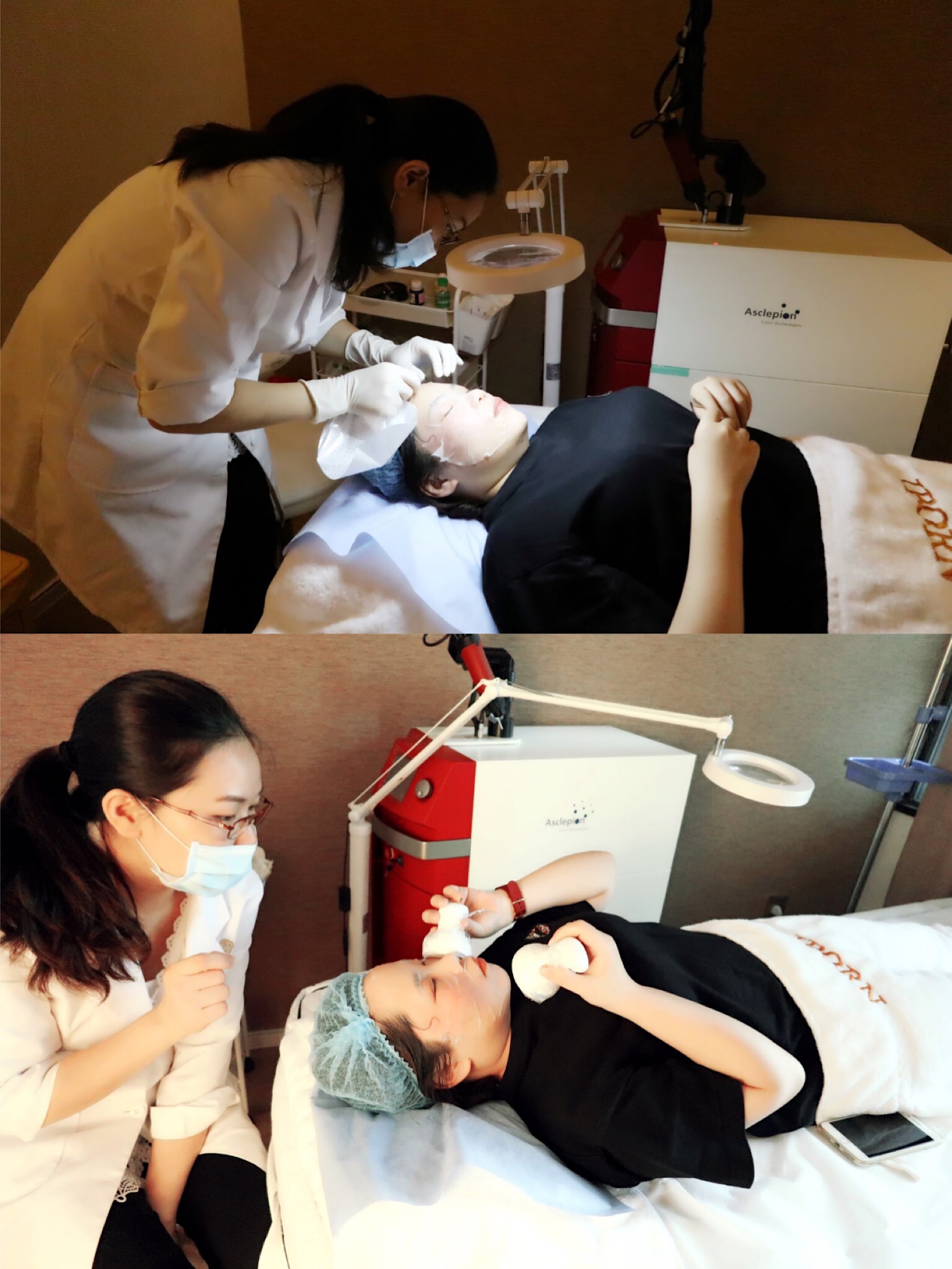 激光祛斑全纪录脸上10年的斑再见啦