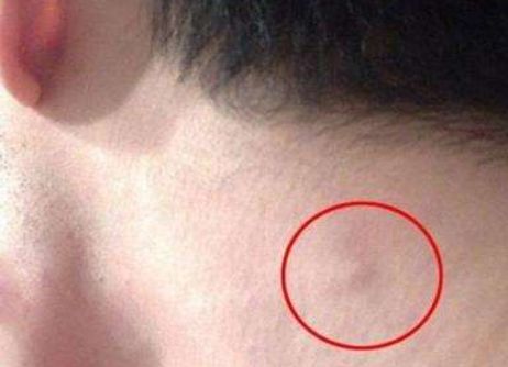 为何患癌的人越来越多预防癌症少碰三物谨记四句话