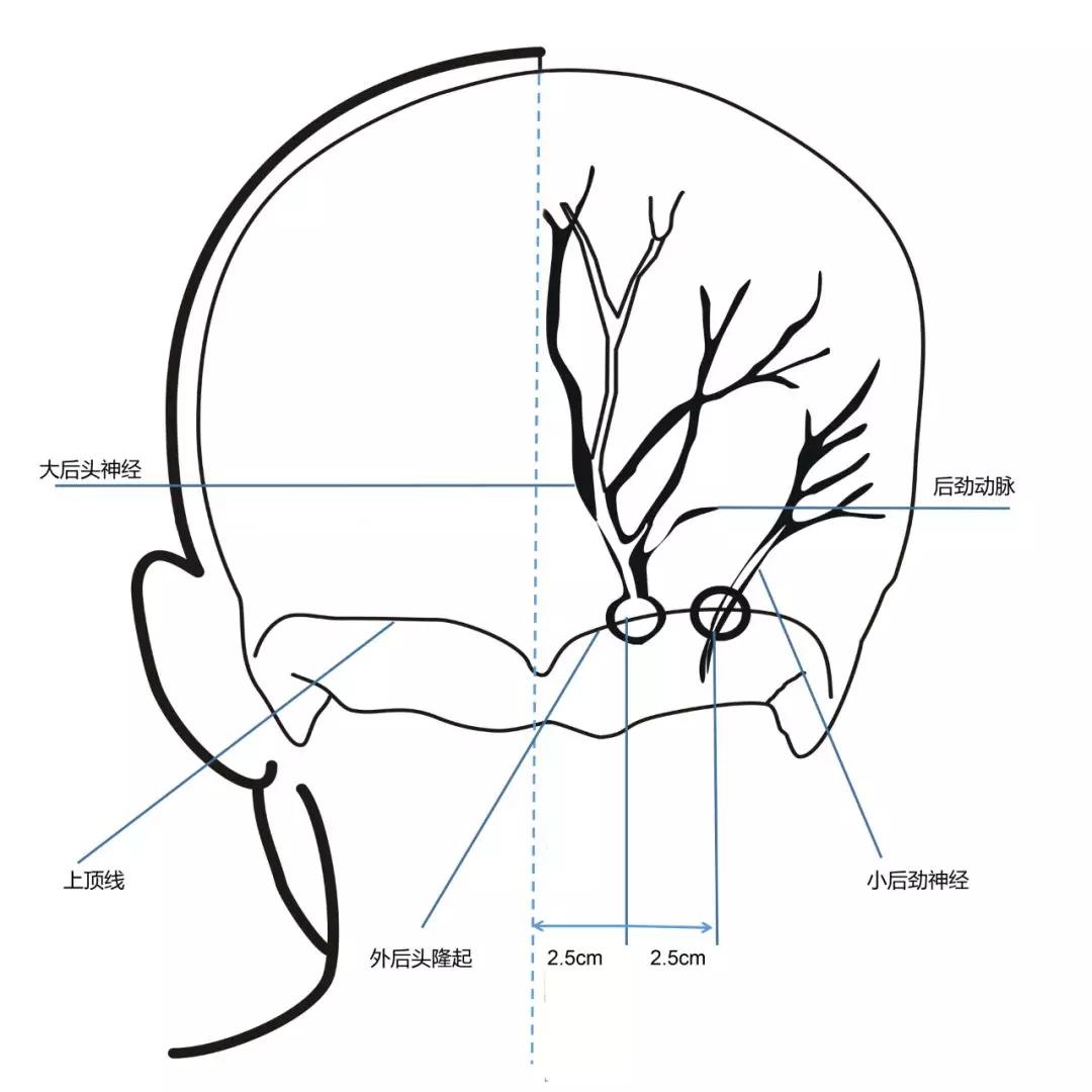 艾利特偏振光治疗仪在临床上的应用【系列1:神经治疗】