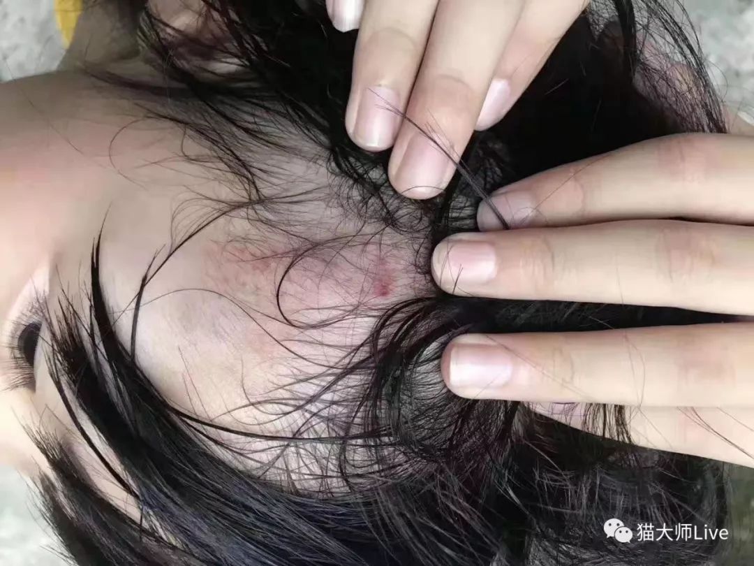 潮汕一8岁女孩遭男子踢打,头部多处受伤