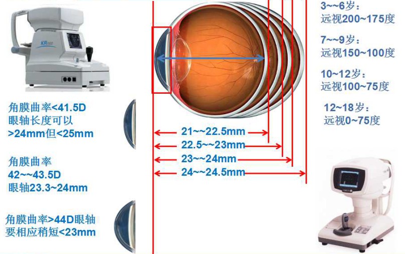 爱尔眼科从专业检查谈近视防控