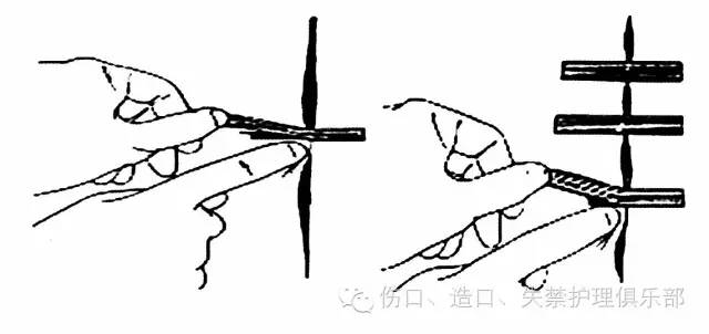 【 收藏】伤口敷料粘贴技巧_胶布