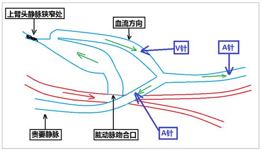 静脉瓣血流方向示意图图片