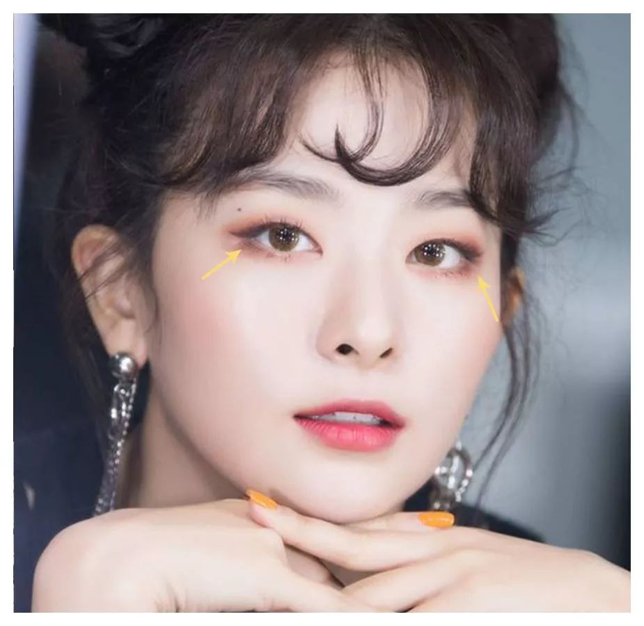 单眼皮,肿眼泡,内双也有救!