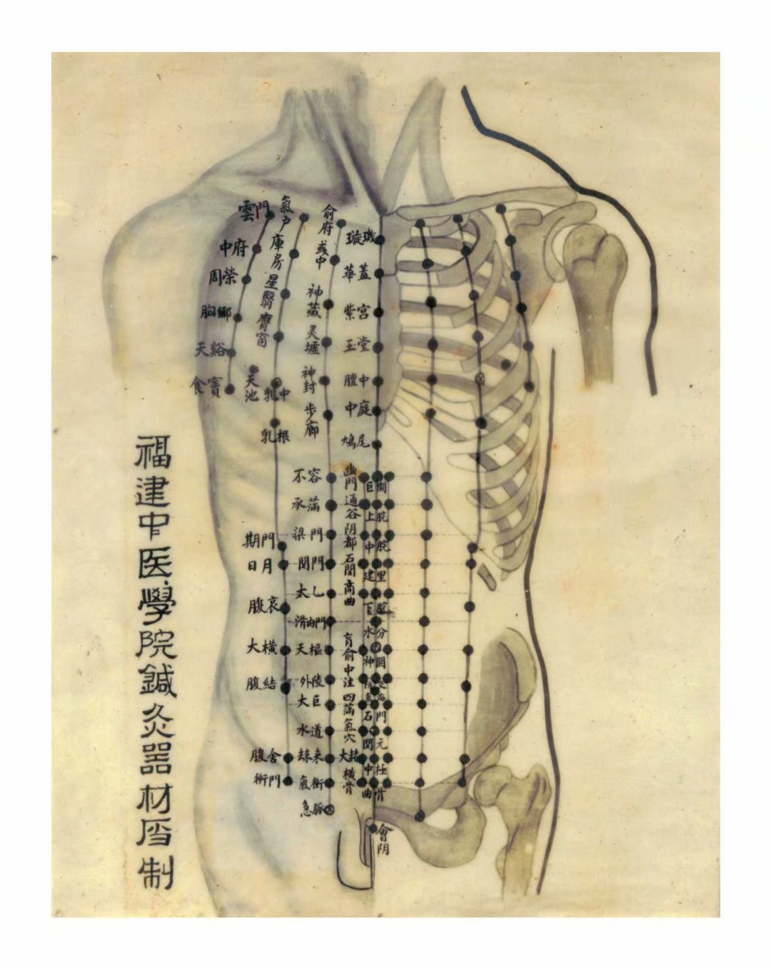 针灸位置图yemen图片