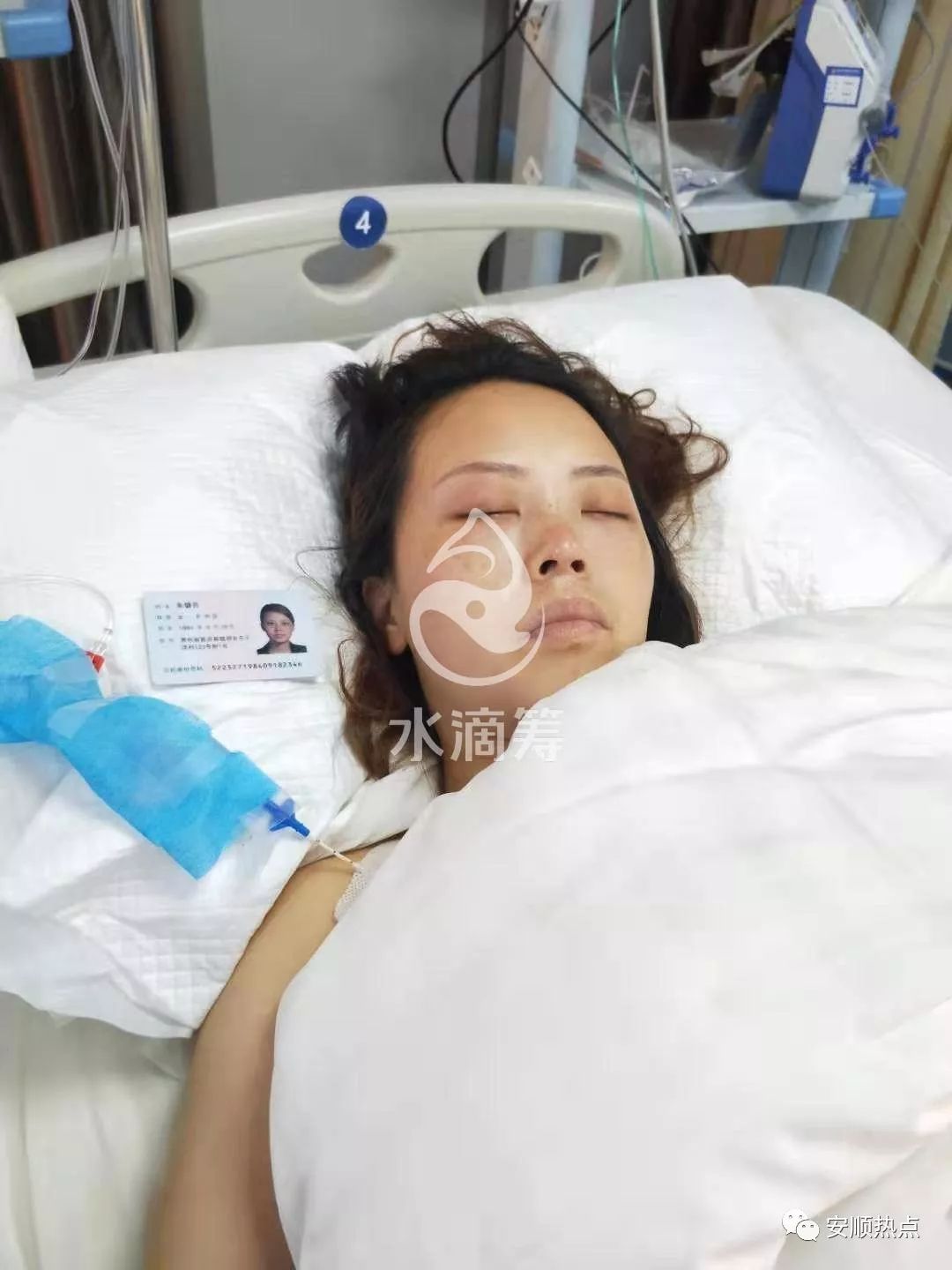 离婚2年后普定女子被前夫砍伤急需帮助