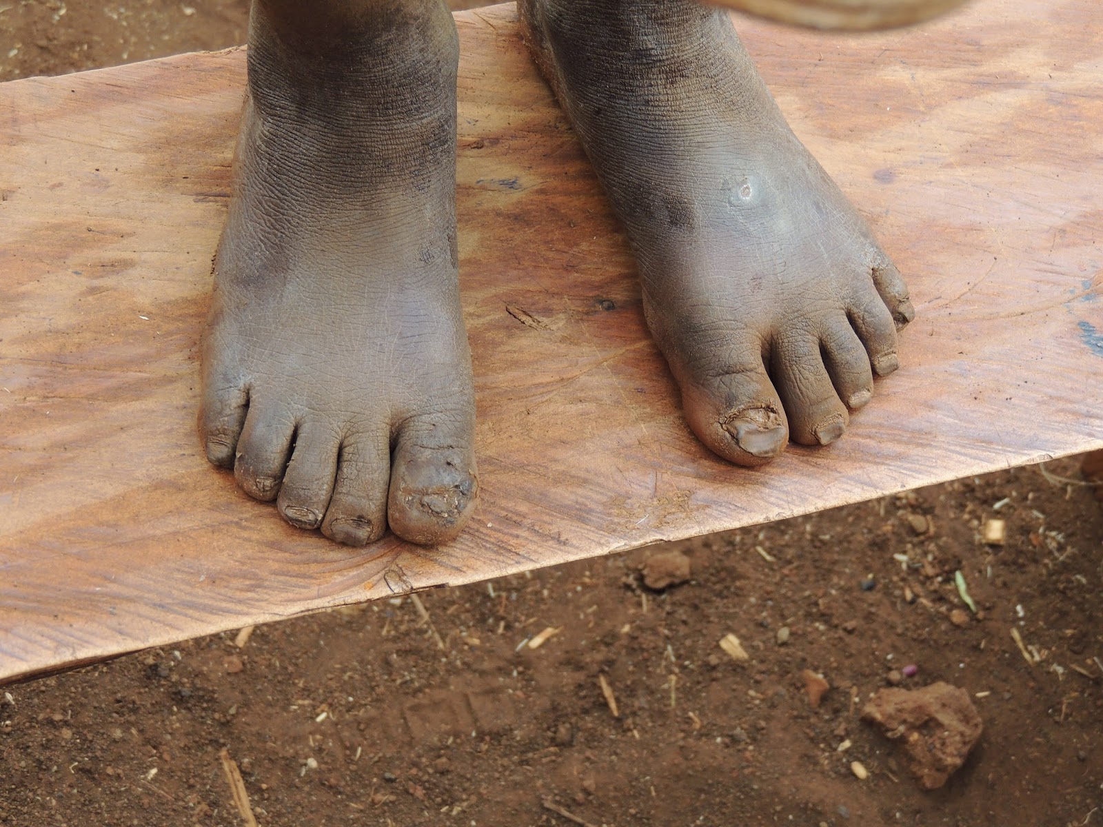 非洲砍手砍脚事件图片