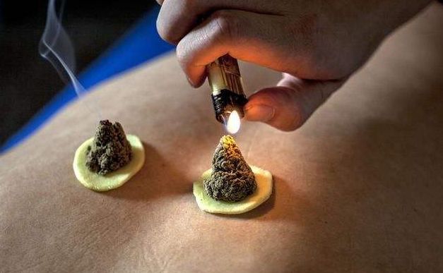 老中医死前留下17个艾灸方,每一个都是无价之宝,建议收藏_姜灸